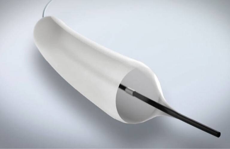 Airiver Medical secures FDA IDE for pulmonary drug-coated balloon to treat central airway stenosis